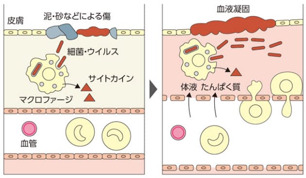 強い酒ほどリスク大 アルコールは免疫力を下げる ヘルスup Nikkei Style