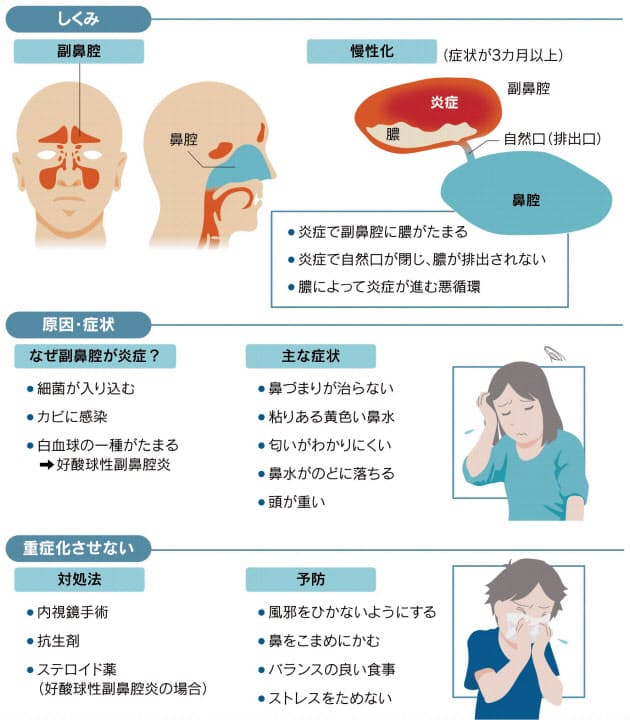 鼻腔 症状 副 炎