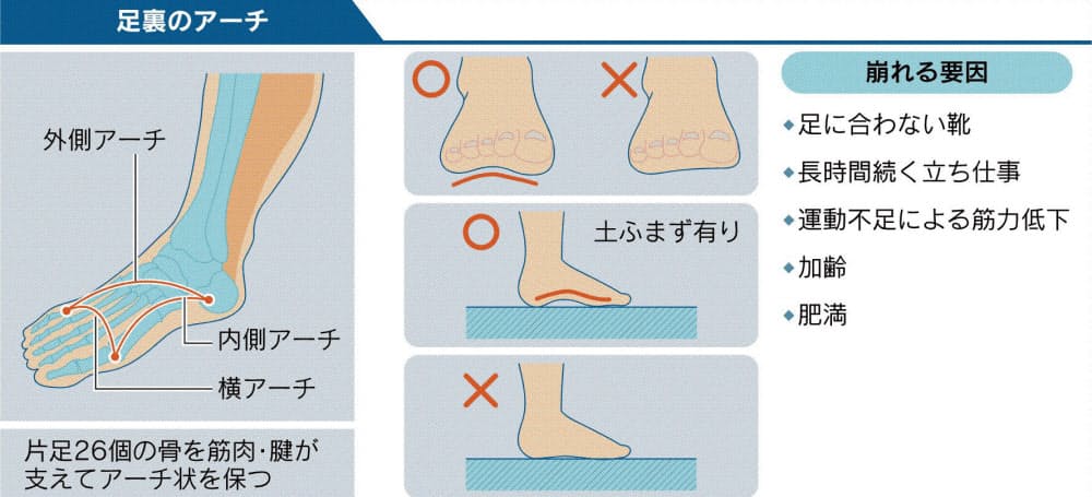 足トラブルはアーチ構造の崩れから 足裏筋トレで予防 Nikkei Style