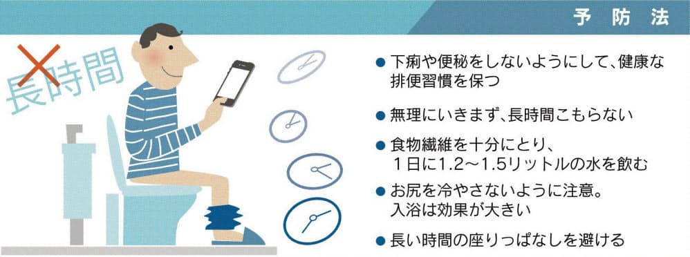 在宅で座りっぱなし 寒い季節 実践したい痔の予防法 Nikkei Style 在宅で座りっぱなし 寒い季節 実践したい痔の予防法 Nikkei Style