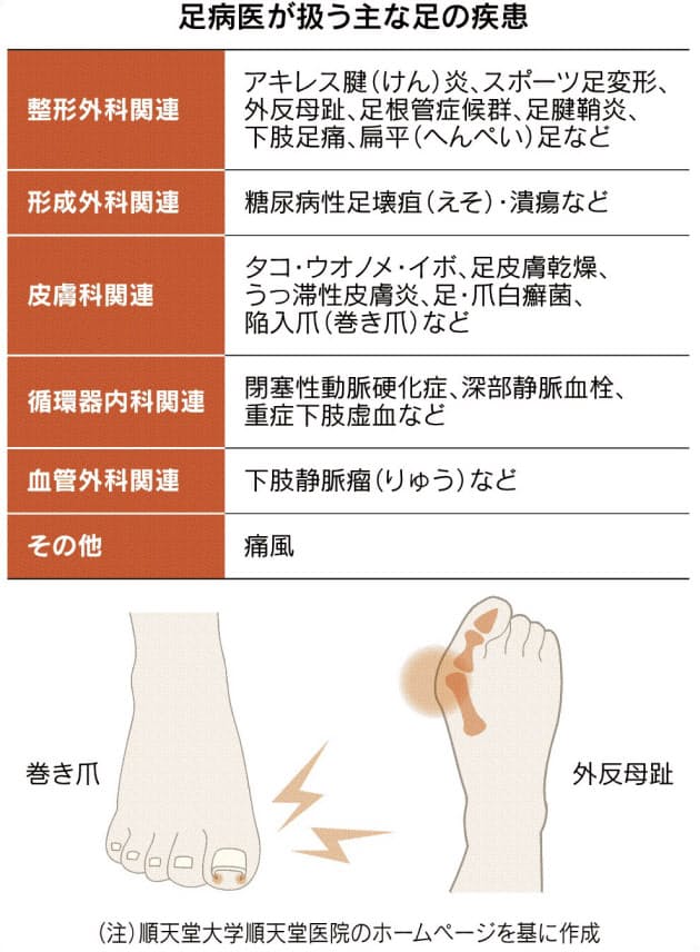 足の異常に 足病医 高齢化でニーズ 診療科を横断 Nikkei Style 足の異常に 足病医 高齢化でニーズ 診療科を横断 Nikkei Style