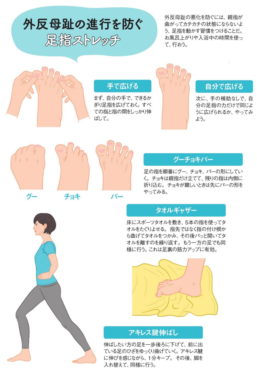 外反母趾を防ぐには 足指ストレッチでやわらかさ保つ Nikkei Style