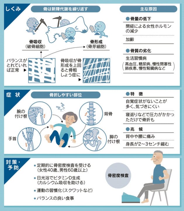 骨粗しょう症は早めに予防 生活習慣病で男性も発症 Nikkei Style 骨粗しょう症は早めに予防 生活習慣病で男性も発症 Nikkei Style