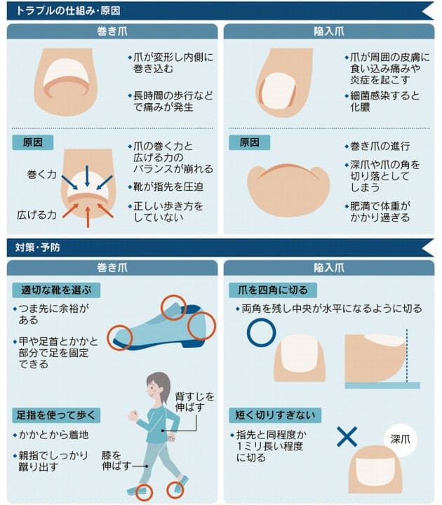 足の爪トラブル早めのケアで予防 体支える親指に多く Nikkei Style