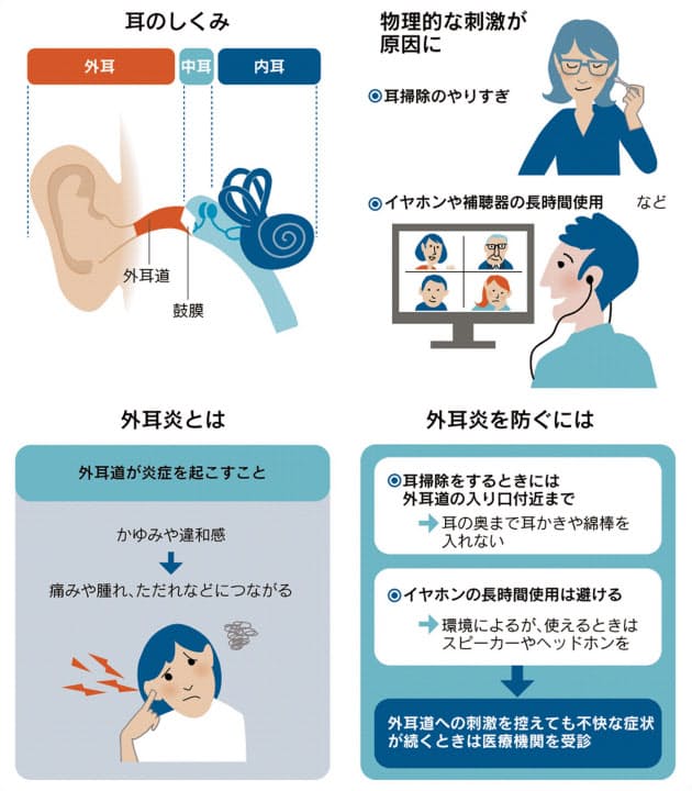 外耳炎でかゆみ 痛み イヤホン使いすぎも原因 Nikkei Style