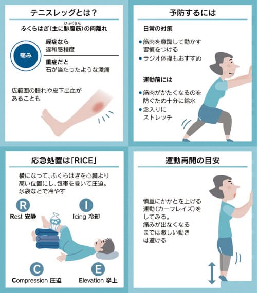 ふくらはぎの肉離れ 中高年 急な動きに要注意 ストレッチや給水で予防 Nikkei Style Goo ニュース ふくらはぎの肉離れ 中高年 急な動きに要注意 ストレッチや給水で予防 Nikkei Style Goo ニュース