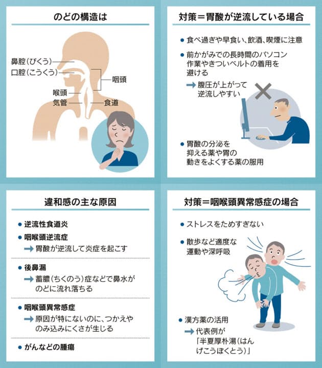 のどのつかえ 違和感 胃酸逆流やストレスが原因も Nikkei Style のどのつかえ 違和感 胃酸逆流やストレスが原因も Nikkei Style